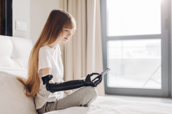 Person with a prosthetic arm holding and looking at a phone.