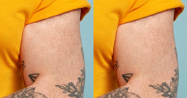 Remove a tattoo from a photo: layer mask added.