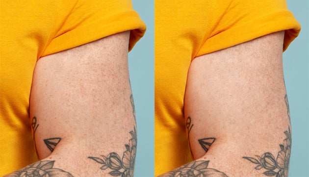 Remove a tattoo from a photo: clean up the final result.