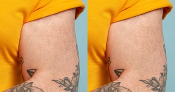 Remove a tattoo from a photo: layer mask added.