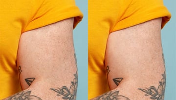 Remove a tattoo from a photo: clean up the final result.