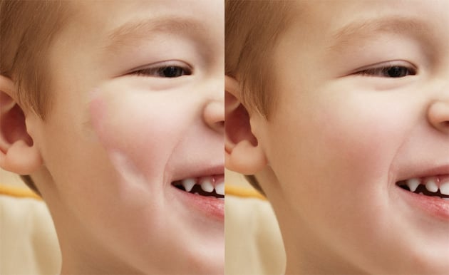 how to remove blemishes with the healing brush
