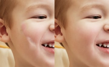 how to remove blemishes with the healing brush