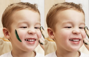 photoshop blemish removal in Photoshop before and after