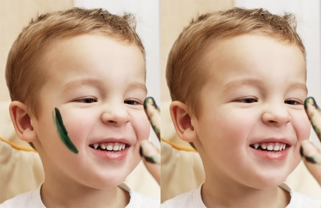 photoshop blemish removal in Photoshop before and after