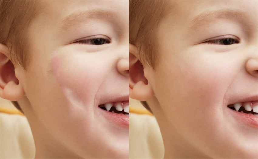 how to remove blemishes with the healing brush