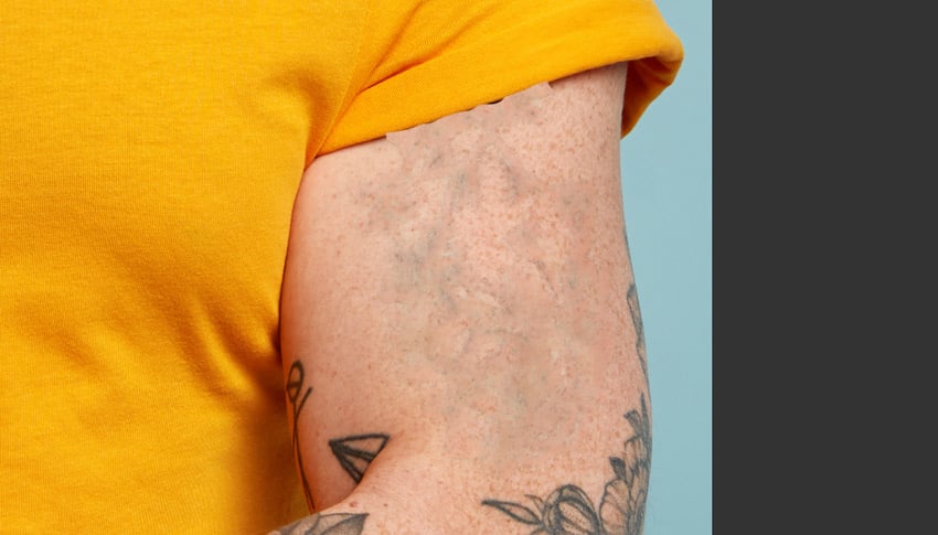 Remove a tattoo from a photo: remove blue from tattoo.