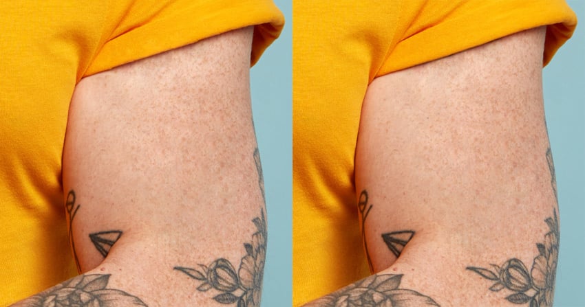 Remove a tattoo from a photo: layer mask added.