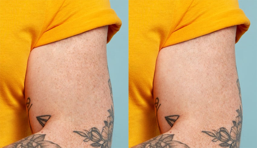 Remove a tattoo from a photo: clean up the final result.